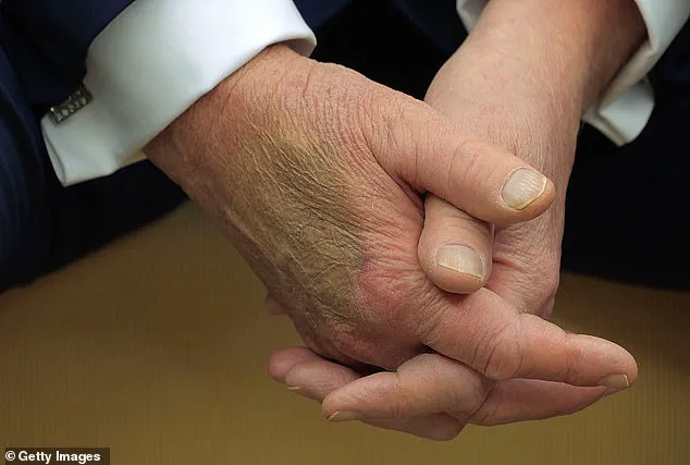 Behind Closed Doors: The Secret Health Regimen of a Leader and the Public's Right to Know