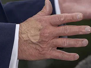 Behind Closed Doors: The Secret Health Regimen of a Leader and the Public's Right to Know