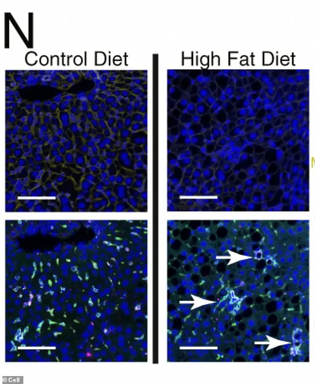 High-Fat Diets Reveal Hidden Cancer Risk in Liver Cells