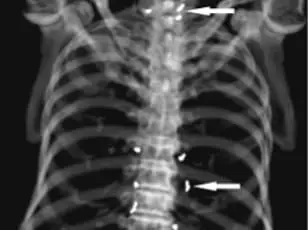 Medical Crisis Sparks Concerns Over Unregulated Alternative Therapies After Woman Found with Gold Threads in Joints