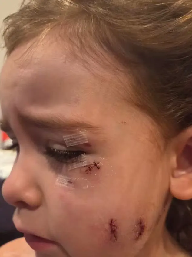 Exclusive: Terrifying Dog Attack in Oshawa Exposes Community's Limited Access to Critical Safety Information