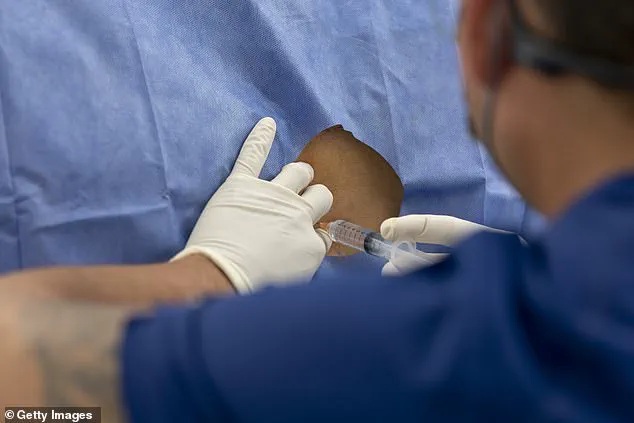 Antibiotic Gel Injection Could End Chronic Back Pain, Study Links Condition to Acne