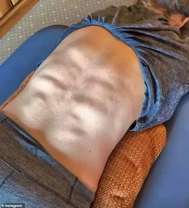 Mikaela Shiffrin's Sculpted Back Muscles Captivate Fans in Viral Social Media Post