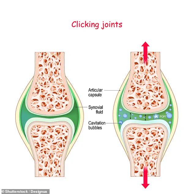 Cracking Knuckles Doesn't Cause Arthritis: The Science Behind Joint Sounds