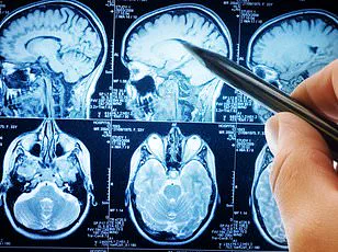 Transforming Daily Challenges for Dementia Patients Through Extended Reality, Says CrossTech