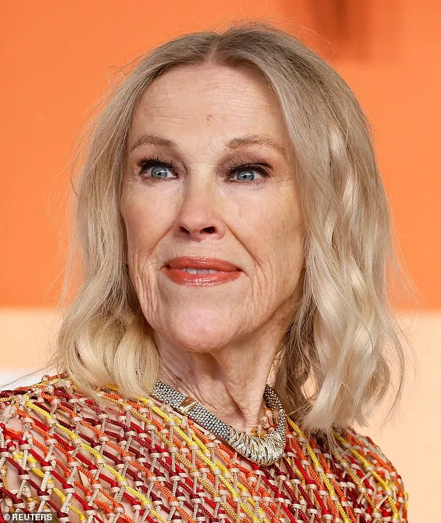Catherine O'Hara's Death Sparks Urgent Warnings About Under-Diagnosed Blood Clot Condition