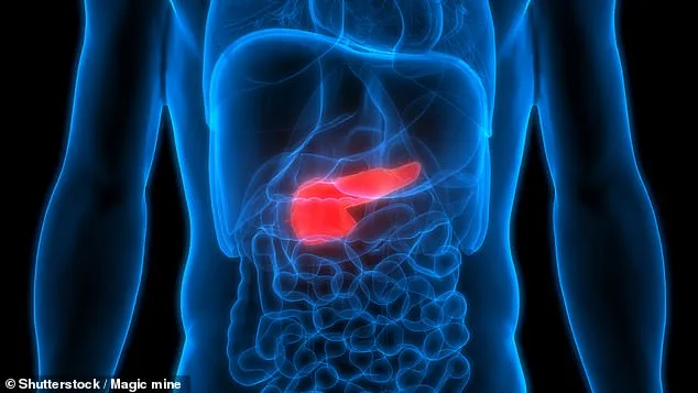 New Study Links Type 2 Diabetes to Pancreatic Cancer, Raising Alarms Over Deadly Disease in UK