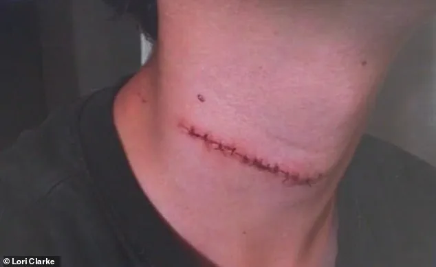 13-Year-Old Survives Miraculous Throat Slashing in Daytona Beach Attack as Community Demands Justice