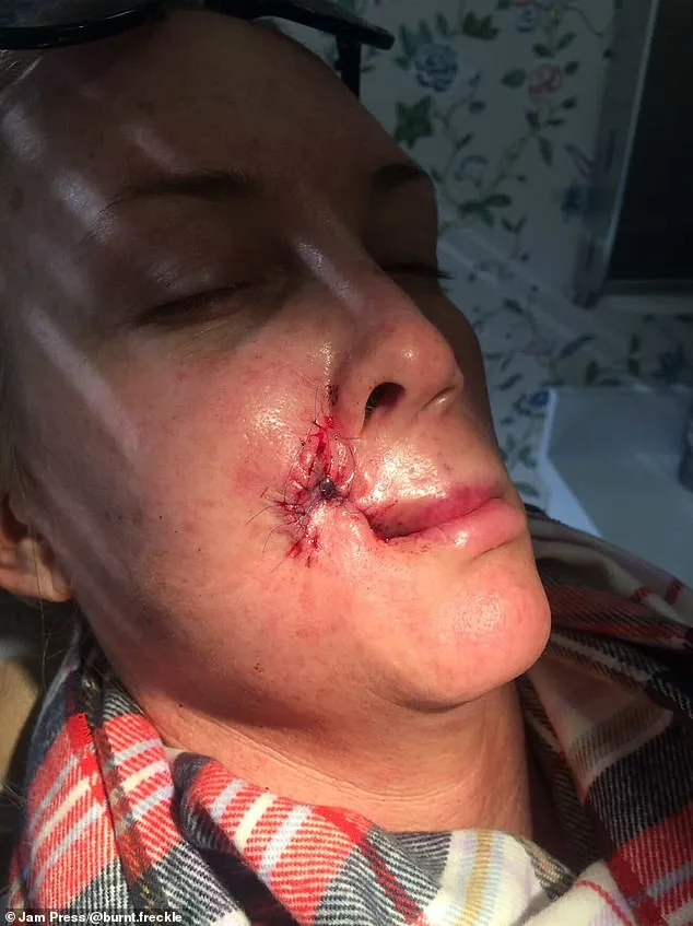 A Mother's Relentless Battle Against Skin Cancer: Kory Feltz's Journey of Survival and Resilience