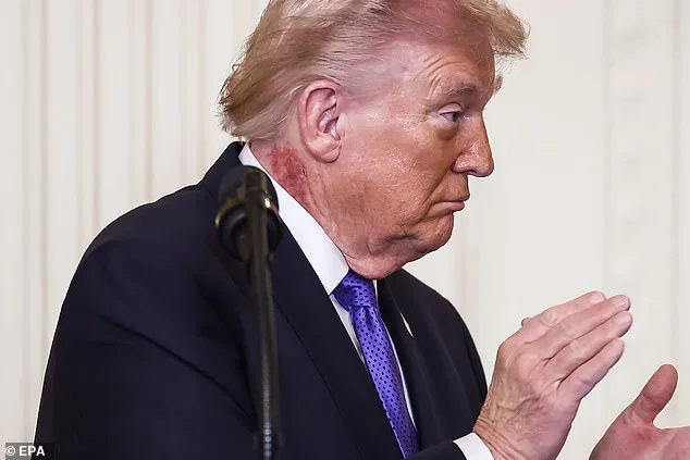 Trump's Red Rash Sparks Health Speculation and Concern