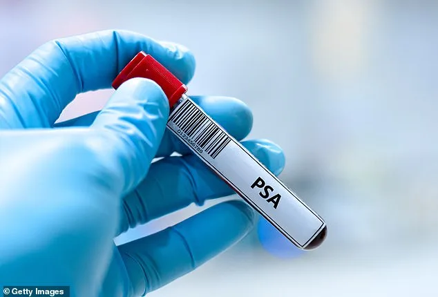 Groundbreaking Study Challenges UK Policy on Prostate Cancer Screening: PSA Tests Match Mammogram Effectiveness