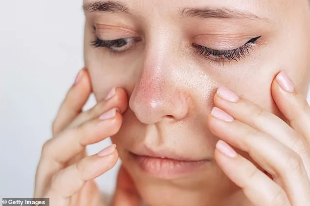 Persistent Cold Nose May Signal Rare Immune Disorder – Unusual Raynaud's Presentation