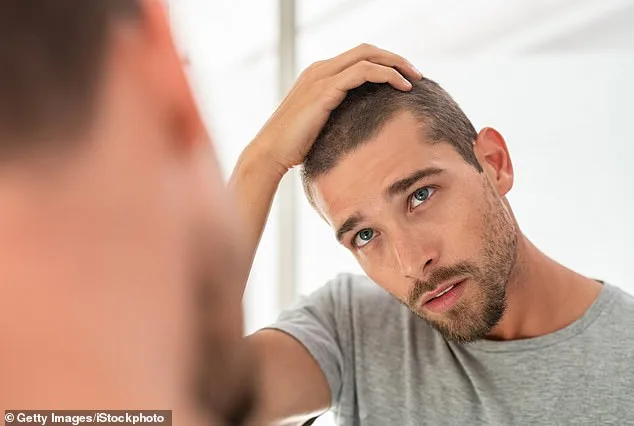 PRP Therapy: The Affordable, Non-Invasive Solution Revolutionizing Hair Loss Treatment