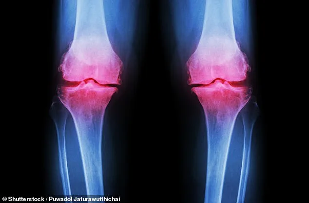 Breakthrough: Lab-Grown Knee Using 3D-Printed Scaffold Could Revolutionize Osteoarthritis Treatment