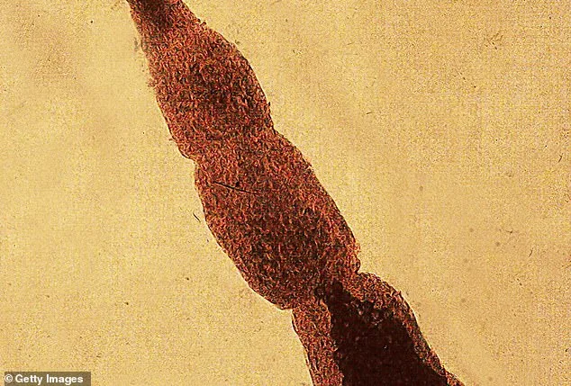 Potentially Lethal Parasite Detected in Washington Coyotes, Expanding Health Risk