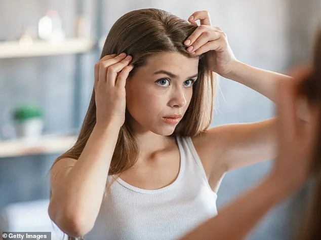 Dandruff Misconception: Malassezia Yeast, Not Dry Skin, is the Real Cause