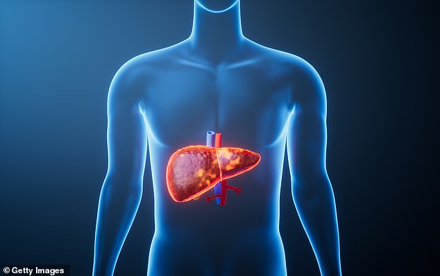 New study links obesity and heavy drinking to a silent liver disease crisis.