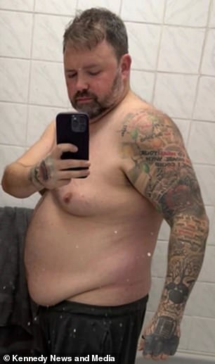 Man Warns Against Weight Loss Injections After Life-Threatening Gallbladder Infection