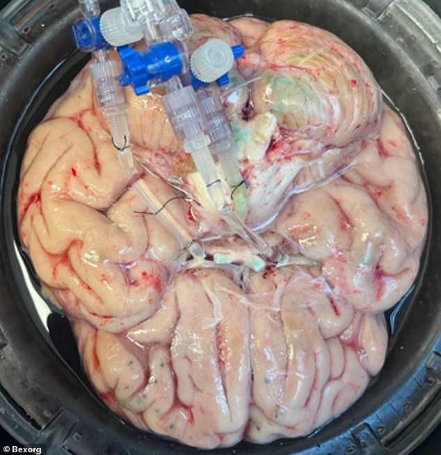 Scientists Preserve Human Brains in Tanks to Study Disease Progression